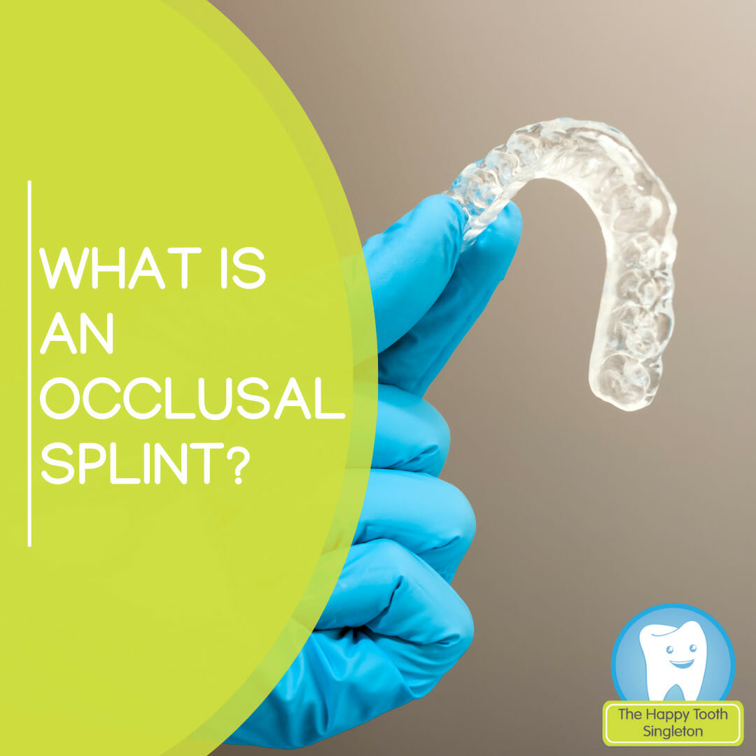 Occlusal Splint | The Happy Tooth Singleton