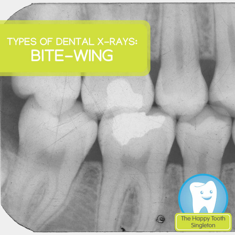 Types of dental xrays Bitewing The Happy Tooth Singleton