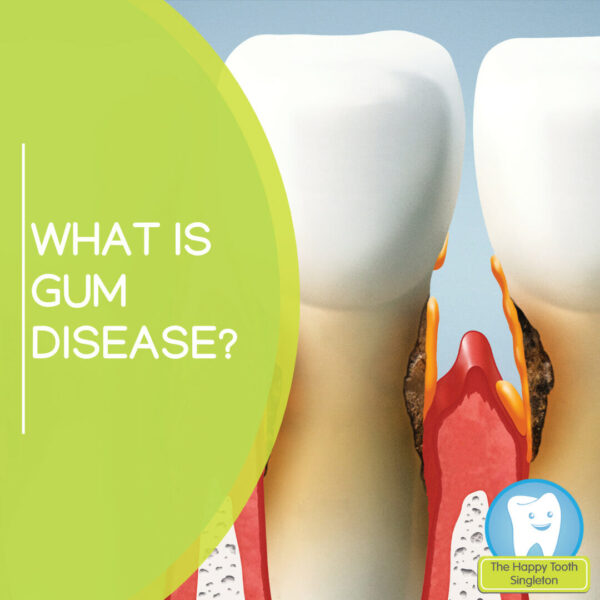 Gum Disease