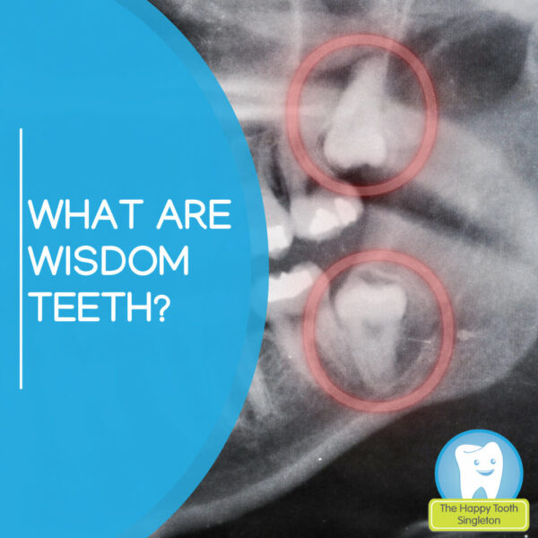 Wisdom Teeth